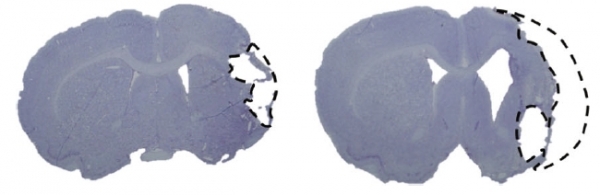유도만능줄기세포 유래 신경전구세포 이식한 그룹과 대조군의 뇌경색 부피 비교 이미지(사진제공 : 차 의과대학교)